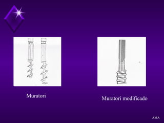 Muratori Muratori modificado
AMA
 