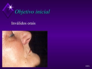 Objetivo inicialObjetivo inicial
Inválidos orais
AMA
 