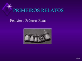 PRIMEIROS RELATOS
Fenícios : Próteses Fixas
AMA
 