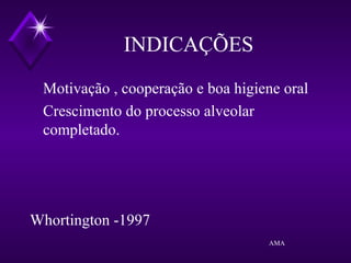 INDICAÇÕES
Motivação , cooperação e boa higiene oral
Crescimento do processo alveolar
completado.
Whortington -1997
AMA
 