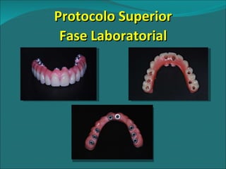 Protocolo Superior Fase Laboratorial 
