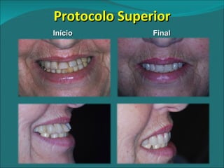 Protocolo Superior Início Final 