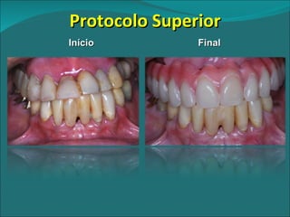 Protocolo Superior Início Final 