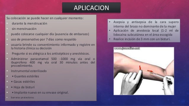 Implantes subdermico
