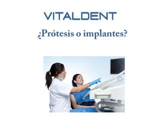 Implantes vital dent o protesis vital dent
