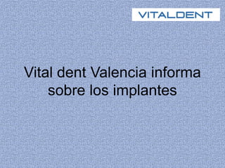 Vital dent Valencia informa
sobre los implantes
 