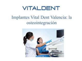 Implantes Vital Dent Valencia: la
osteointegración
 