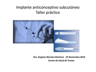 Implante anticonceptivo subcutáneo
Taller práctico
Dra. Ángeles Morales Martínez 22 Noviembre 2019
Centro de Salud de Trevias
 