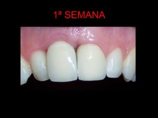 1ª SEMANA
 