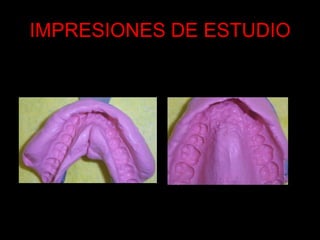 IMPRESIONES DE ESTUDIO
 