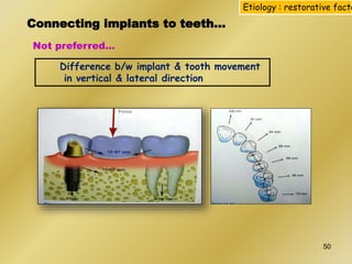 Connecting implants to teeth…
Not preferred…
Difference b/w implant & tooth movement
in vertical & lateral direction
Etiology : restorative facto
50
 
