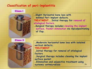 Classification of peri-implantitis
Class I
…Slight Horizontal bone loss with
minimal Peri-implant defects.
TREATMENT……Initial therapy for removal of
etiological factors.
…Surgical therapy includes cleaning the implant
surface, Pocket elimination via Apicalpositioning
of flap.
Class II
…Moderate horizontal bone loss with isolated
vertical defects.
TREATMENT
…Initial therapy for removal of etiological
factors
…Surgical therapy includes cleaning the implant
surface pocket
…Elimination and adjunctive treatment using
systemic antimicrobials 79
 