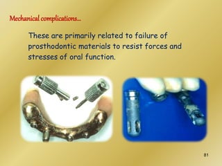 These are primarily related to failure of
prosthodontic materials to resist forces and
stresses of oral function.
Mechanical complications…
81
 
