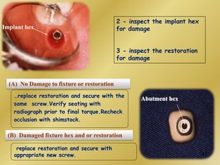 2 - inspect the implant hex
for damage
3 - inspect the restoration
for damage
Implant hex
Abutment hex
(A) No Damage to fixture or restoration
…replace restoration and secure with the
same screw.Verify seating with
radiograph prior to final torque.Recheck
occlusion with shimstock.
(B) Damaged fixture hex and or restoration
replace restoration and secure with
appropriate new screw. 87
 