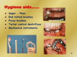 Hygiene aids……
Super - floss
End tufted brushes
Proxy brushes
Tartar control dentrifices
Mechanical instruments
94
 