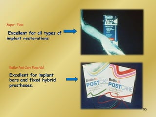 Super - Floss
Excellent for all types of
implant restorations
Butler Post Care Floss Aid
Excellent for implant
bars and fixed hybrid
prostheses.
95
 