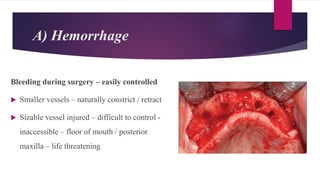 A) Hemorrhage
Bleeding during surgery – easily controlled
 Smaller vessels – naturally constrict / retract
 Sizable vessel injured – difficult to control -
inaccessible – floor of mouth / posterior
maxilla – life threatening
 