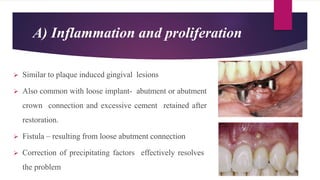 A) Inflammation and proliferation
 Similar to plaque induced gingival lesions
 Also common with loose implant- abutment or abutment
crown connection and excessive cement retained after
restoration.
 Fistula – resulting from loose abutment connection
 Correction of precipitating factors effectively resolves
the problem
 