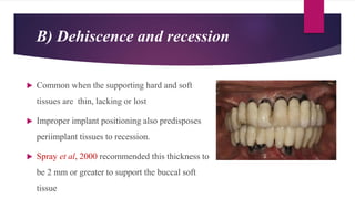 B) Dehiscence and recession
 Common when the supporting hard and soft
tissues are thin, lacking or lost
 Improper implant positioning also predisposes
periimplant tissues to recession.
 Spray et al, 2000 recommended this thickness to
be 2 mm or greater to support the buccal soft
tissue
 