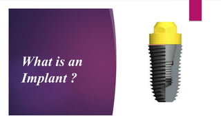 What is an
Implant ?
 