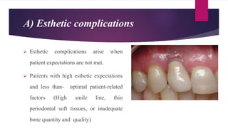 A) Esthetic complications
 Esthetic complications arise when
patient expectations are not met.
 Patients with high esthetic expectations
and less than- optimal patient-related
factors (High smile line, thin
periodontal soft tissues, or inadequate
bone quantity and quality)
 