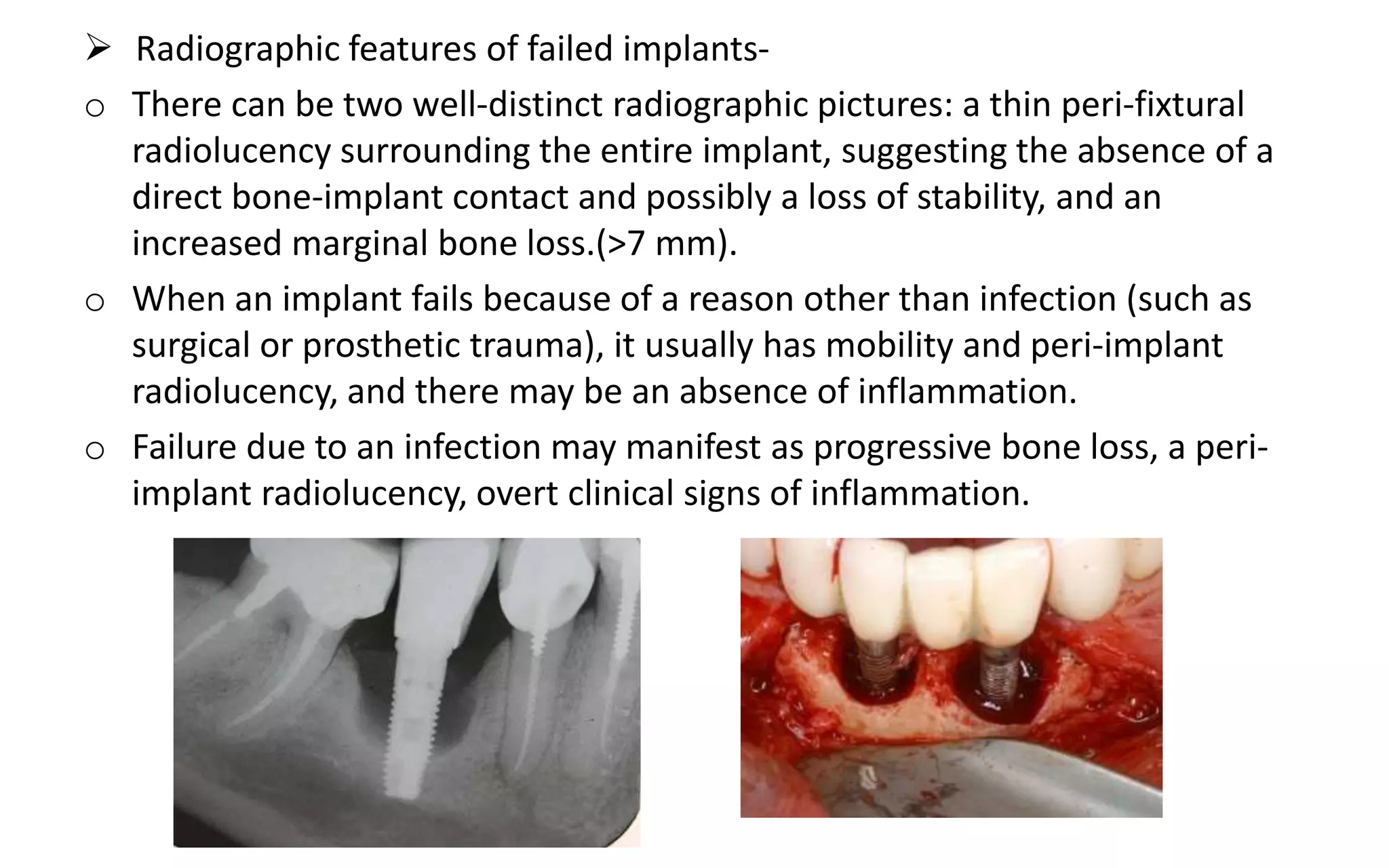 Implant failure , complications and treatment, management- Partha ...