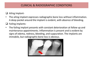 CLINICAL & RADIOGRAPHIC CONDITIONS
 Ailing Implant-
• The ailing implant expresses radiographic bone loss without inflammation.
A deep pocket around the implant is evident, with absence of bleeding.
 Failing implants-
• The failing implant presents with constant deterioration at follow up and
maintenance appointments. Inflammation is present and is evident by
signs of edema, redness, bleeding, and suppuration. The implants are
immobile, but radiographic bone loss is obvious.
 