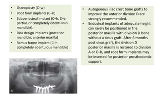 • Osteoplasty (C–w)
• Root form implants (C–h)
• Subperiosteal implant (C–h, C–a
partial, or completely edentulous
mandible).
• Disk design implants (posterior
mandible, anterior maxilla)
• Ramus frame implant (C–h
completely edentulous mandible)
• Autogenous iliac crest bone grafts to
improve the anterior division D are
strongly recommended.
• Endosteal implants of adequate height
can rarely be positioned in the
posterior maxilla with division D bone
without a sinus graft. After 6 months
post sinus graft, the division D
posterior maxilla is restored to division
A or C–h, and root form implants may
be inserted for posterior prosthodontic
support.
 