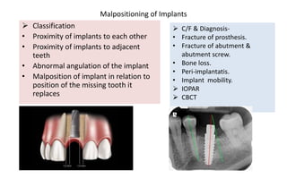 Malpositioning of Implants
 Classification
• Proximity of implants to each other
• Proximity of implants to adjacent
teeth
• Abnormal angulation of the implant
• Malposition of implant in relation to
position of the missing tooth it
replaces
 C/F & Diagnosis-
• Fracture of prosthesis.
• Fracture of abutment &
abutment screw.
• Bone loss.
• Peri-implantatis.
• Implant mobility.
 IOPAR
 CBCT
 