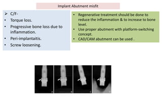  C/F-
• Torque loss.
• Progressive bone loss due to
inflammation.
• Peri-implantaitis.
• Screw loosening.
• Regenerative treatment should be done to
reduce the inflammation & to increase to bone
level.
• Use proper abutment with platform-switching
concept.
• CAD/CAM abutment can be used .
Implant Abutment misfit
 