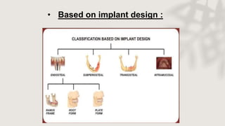 • Based on implant design :
 