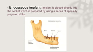 • Endosseous implant: Implant is placed directly into
the socket which is prepared by using a series of specially
prepared drills.
 