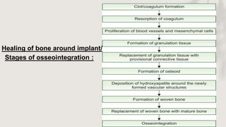 Stages of osseointegration :
Healing of bone around implant/
 
