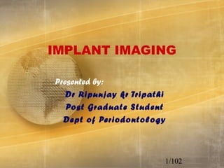 08/08/18 1
IMPLANT IMAGING
Presented by:
Dr Ripunjay kr Tripathi
Post Graduate Student
Dept of Periodontology
1/102
 