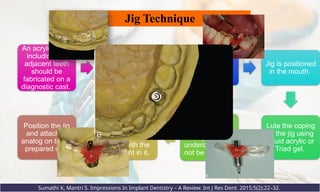 An acrylic splint
including 3-4
adjacent teeth
should be
fabricated on a
diagnostic cast.
Space is
created in the
jig for the future
impression
coping.
After implant
placement,
place the pick-
up coping.
Jig is positioned
in the mouth.
Lute the coping
to the jig using
liquid acrylic or
Triad gel.
Coping screw
should rotate
freely and the
undercut should
not be blocked.
Release the
coping screw
and free the
splint with the
abutment in it.
Position the jig
and attached
analog on to the
prepared cast
Sumathi K, Mantri S. Impressions In Implant Dentistry – A Review. Int J Res Dent. 2015;5(2):22–32.
Jig Technique
 