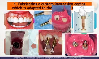 1. Fabricating a custom impression coping
which is adapted to the soft tissue contours
Chee W, Jivraj S. Impression techniques for implant dentistry. Br Dent J. 2006;201(7):429–32.
Provisional
restoration screw
retained on
uncovering
implants
Attach an
analogue to the
provisional
restoration
Place some
impression
material around
the sub mucosal
portion of the
provisional
restoration.
The space around
the customized
impression coping
is filled with acrylic
resin.
The customized
impression coping
is then used in the
impression making
process.
A cast is produced
with the implant
position and soft
tissue representing
the intra oral
condition
 
