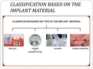 CLASSIFICATION BASED ON THE
IMPLANT MATERIAL
 