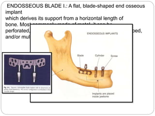 ENDOSSEOUS BLADE I.: A flat, blade-shaped end osseous
implant
which derives its support from a horizontal length of
bone. Most commonly made of metal, it can be
perforated, smooth, fluted, textured, coated, wedge shaped,
and/or multi-headed.
 