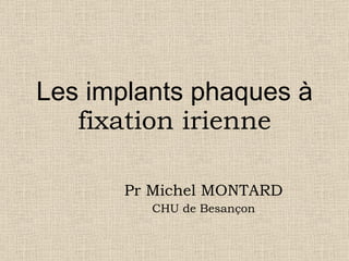 Les implants phaques à  fixation irienne Pr Michel MONTARD CHU de Besançon 