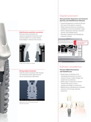 Dental Implant like no other | PDF