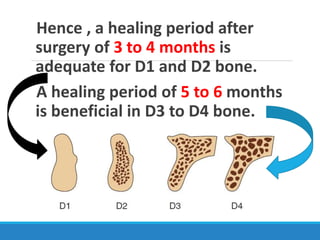 Hence , a healing period after
surgery of 3 to 4 months is
adequate for D1 and D2 bone.
A healing period of 5 to 6 months
is beneficial in D3 to D4 bone.
 