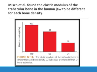Misch et al. found the elastic modulus of the
trabecular bone in the human jaw to be different
for each bone density
 