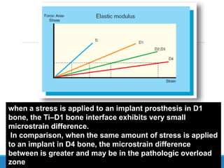 when a stress is applied to an implant prosthesis in D1
bone, the Ti–D1 bone interface exhibits very small
microstrain difference.
In comparison, when the same amount of stress is applied
to an implant in D4 bone, the microstrain difference
between is greater and may be in the pathologic overload
zone
 
