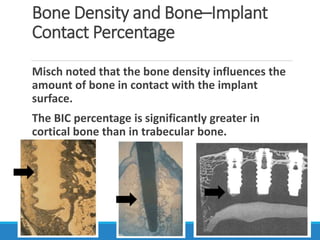 Bone Density and Bone–Implant
Contact Percentage
Misch noted that the bone density influences the
amount of bone in contact with the implant
surface.
The BIC percentage is significantly greater in
cortical bone than in trabecular bone.
 