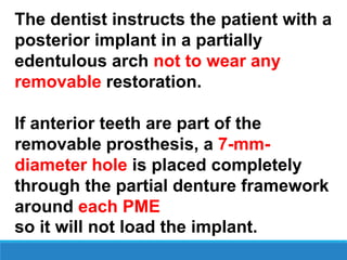The dentist instructs the patient with a
posterior implant in a partially
edentulous arch not to wear any
removable restoration.
If anterior teeth are part of the
removable prosthesis, a 7-mm-
diameter hole is placed completely
through the partial denture framework
around each PME
so it will not load the implant.
 