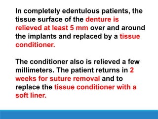 In completely edentulous patients, the
tissue surface of the denture is
relieved at least 5 mm over and around
the implants and replaced by a tissue
conditioner.
The conditioner also is relieved a few
millimeters. The patient returns in 2
weeks for suture removal and to
replace the tissue conditioner with a
soft liner.
 