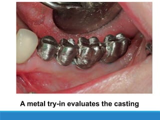 A metal try-in evaluates the casting
 
