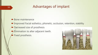 Advantages of implant
 Bone maintenance
 Improved Facial esthetics, phonetic, occlusion, retention, stability
 Decreased size of prosthesis
 Elimination to alter adjacent teeth.
 Fixed prosthesis.
16
 