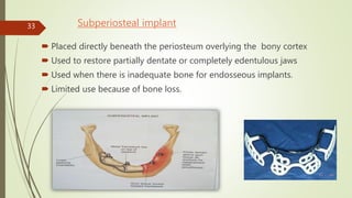 Subperiosteal implant
 Placed directly beneath the periosteum overlying the bony cortex
 Used to restore partially dentate or completely edentulous jaws
 Used when there is inadequate bone for endosseous implants.
 Limited use because of bone loss.
33
 