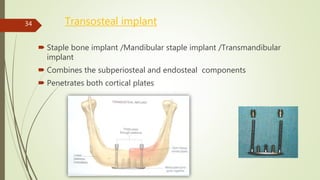 Transosteal implant
 Staple bone implant /Mandibular staple implant /Transmandibular
implant
 Combines the subperiosteal and endosteal components
 Penetrates both cortical plates
34
 